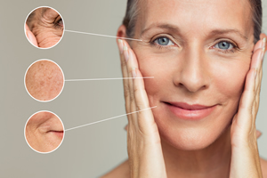 micro-needling St. John's Medispa Services